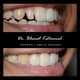 Slider image (9) Dr. Bharat Katarmal Dental and Implant Clinic